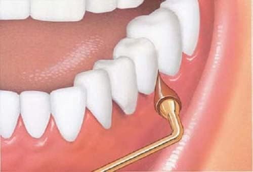 Stimulate Your Smile with G.U.M Classic Gum Stimulator - Pack of 4